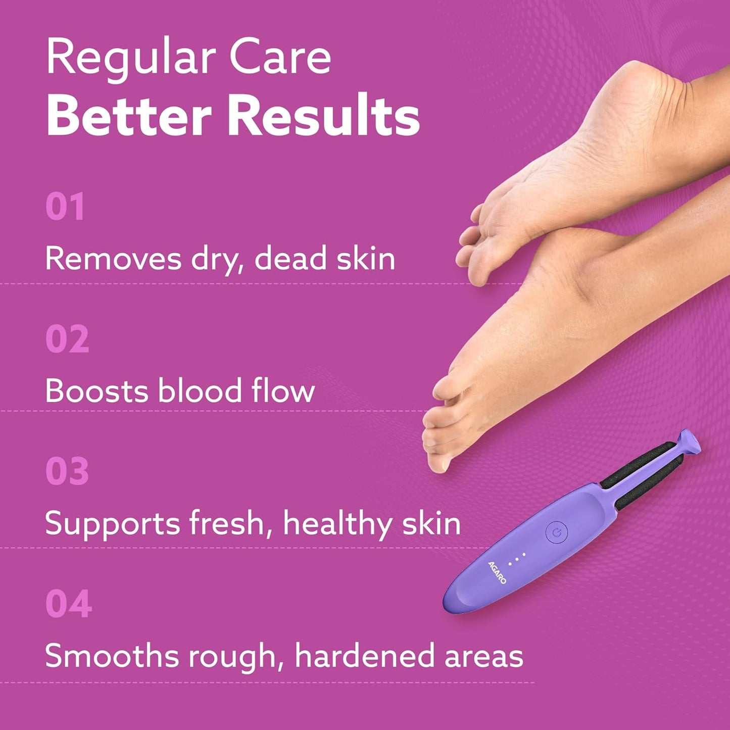 AGARO Electric Callus Remover with 2 Replaceable Heads – Rechargeable Foot Scrubber for Dead Skin & Cracked Heels Pedicure Machine with 120 Minutes Runtime CR1414