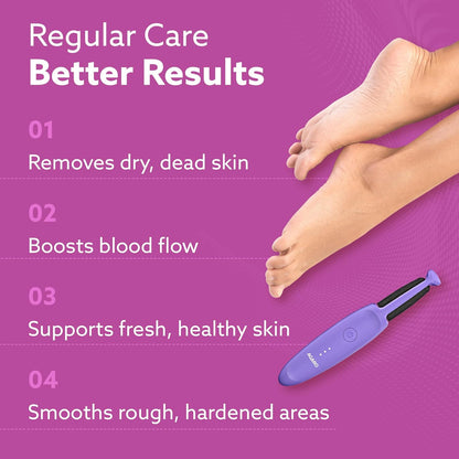 AGARO Electric Callus Remover with 2 Replaceable Heads – Rechargeable Foot Scrubber for Dead Skin & Cracked Heels Pedicure Machine with 120 Minutes Runtime CR1414