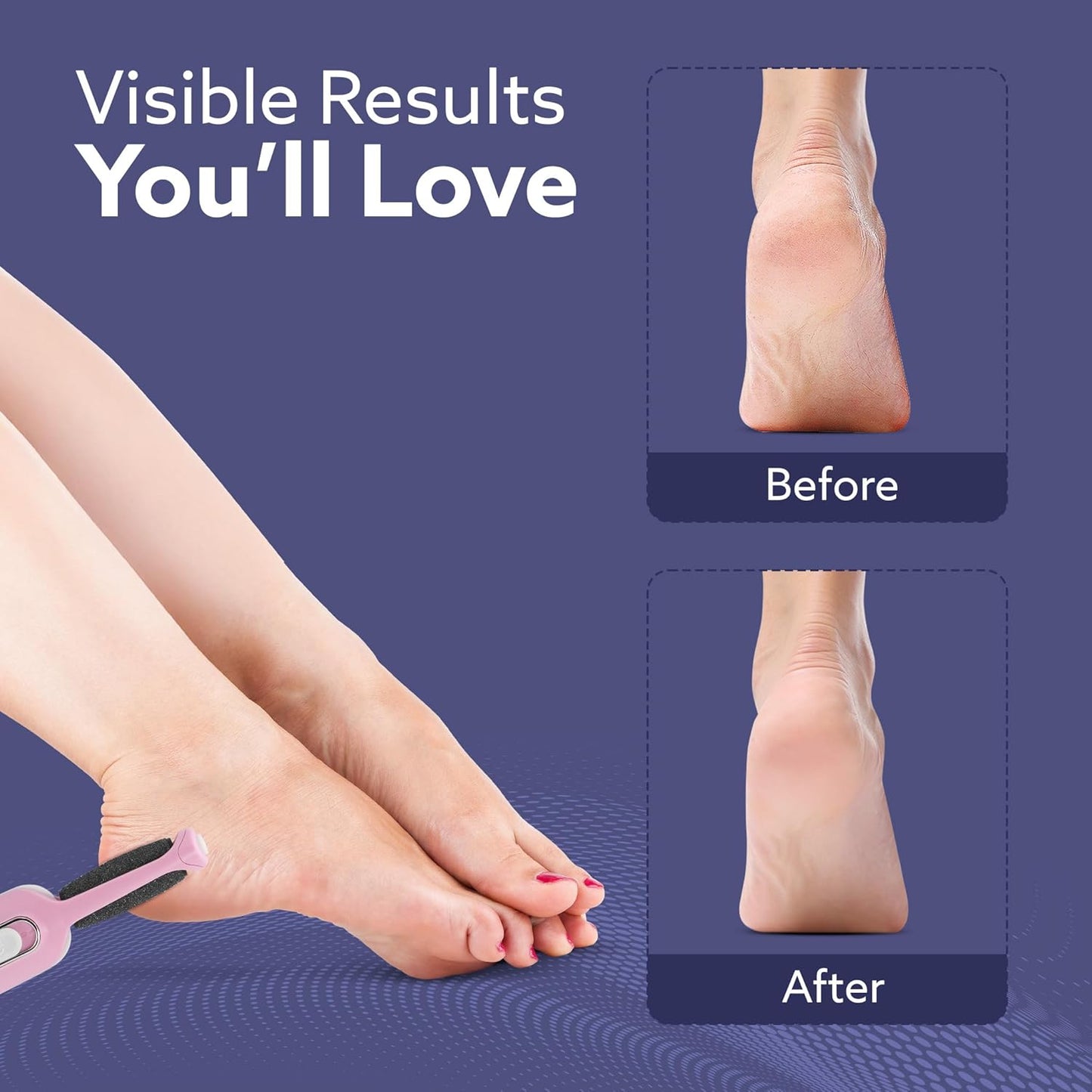 AGARO Electric Callus Remover with 2 Replaceable Heads – Rechargeable Foot Scrubber for Dead Skin & Cracked Heels Pedicure Machine with 120 Minutes Runtime CR1717
